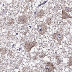 CXXC Finger Protein 11 Antibody, Novus Biologicals 0.1mL; Unlabeled:Antibodies,